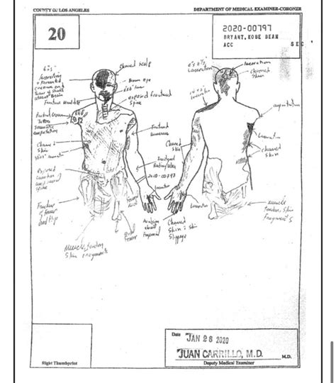 gigi bryant autopsy|File : Gianna Bryants autopsy report (2020).pdf